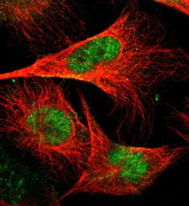 Immunocytochemistry/ Immunofluorescence - Anti-GABPA antibody (AB224325)