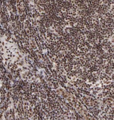 Immunohistochemistry (Formalin/PFA-fixed paraffin-embedded sections) - Anti-GABPA antibody (AB224325), expandable thumbnail