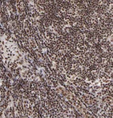 Immunohistochemistry (Formalin/PFA-fixed paraffin-embedded sections) - Anti-GABPA antibody (AB224325)