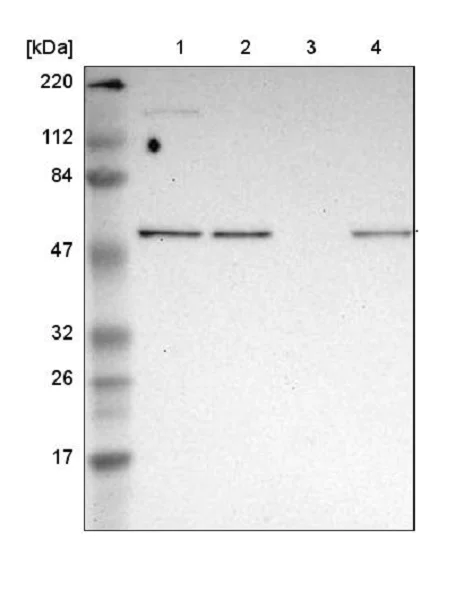 Western blot - Anti-GABPA antibody (AB224325)