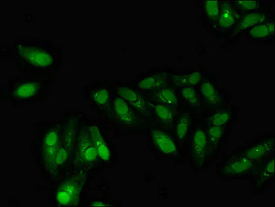 Immunocytochemistry/ Immunofluorescence - Anti-GABPB2 antibody (AB234864)