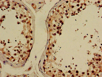 Immunohistochemistry (Formalin/PFA-fixed paraffin-embedded sections) - Anti-GABPB2 antibody (AB234864)