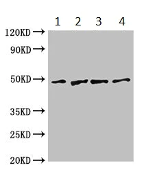 Western blot - Anti-GABPB2 antibody (AB234864)