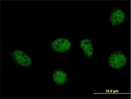 Immunocytochemistry/ Immunofluorescence - Anti-GABPB2/Nuclear respiratory factor 2 antibody (AB88746)