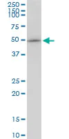 Western blot - Anti-GABPB2/Nuclear respiratory factor 2 antibody (AB88746)