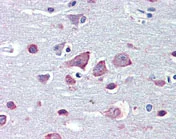 Immunohistochemistry (Formalin/PFA-fixed paraffin-embedded sections) - Anti-GABRA4 antibody (AB117080)