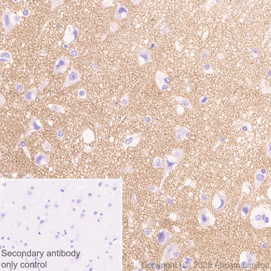 Immunohistochemistry (Formalin/PFA-fixed paraffin-embedded sections) - Anti-GABRA4 antibody [EPR28365-209] (AB323502), expandable thumbnail