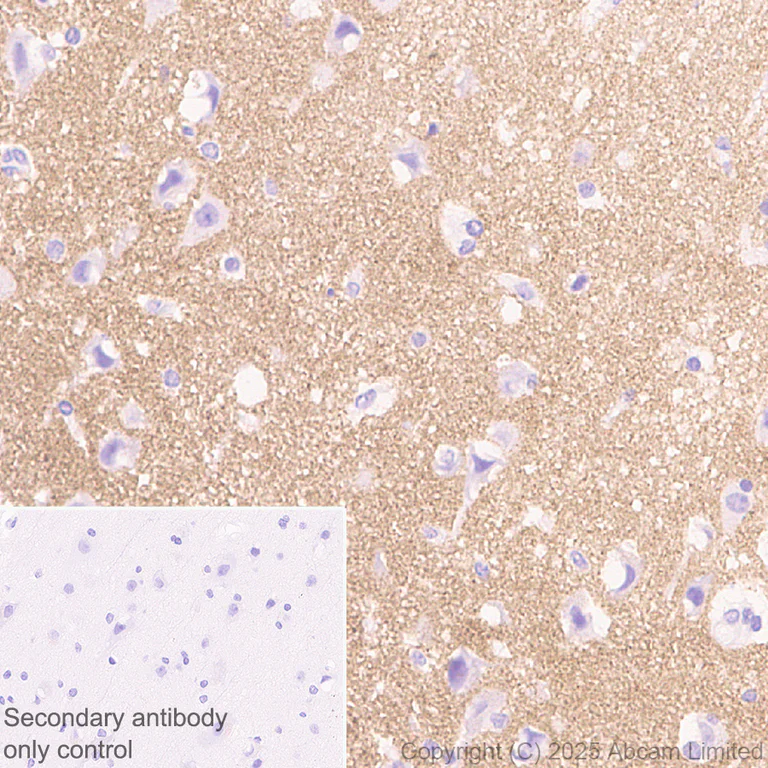 Immunohistochemistry (Formalin/PFA-fixed paraffin-embedded sections) - Anti-GABRA4 antibody [EPR28365-209] (AB323502)