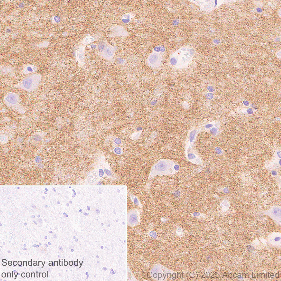 Immunohistochemistry (Formalin/PFA-fixed paraffin-embedded sections) - Anti-GABRA4 antibody [EPR28365-209] (AB323502), expandable thumbnail