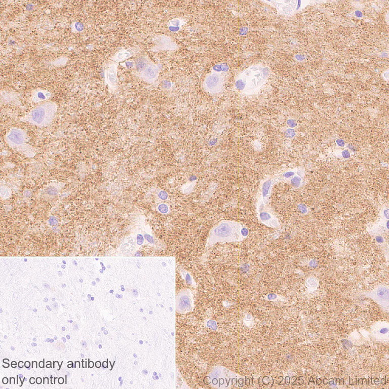 Immunohistochemistry (Formalin/PFA-fixed paraffin-embedded sections) - Anti-GABRA4 antibody [EPR28365-209] (AB323502)