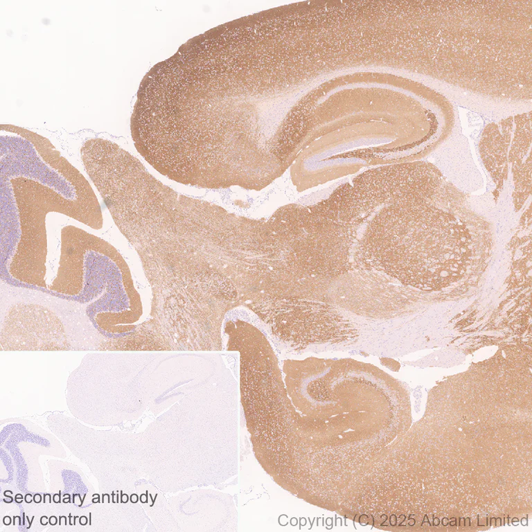 Immunohistochemistry (Formalin/PFA-fixed paraffin-embedded sections) - Anti-GABRA4 antibody [EPR28365-209] (AB323502)