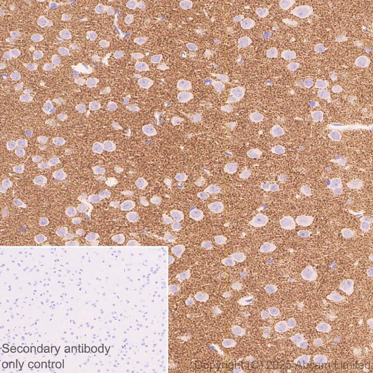 Immunohistochemistry (Formalin/PFA-fixed paraffin-embedded sections) - Anti-GABRA4 antibody [EPR28365-209] (AB323502)