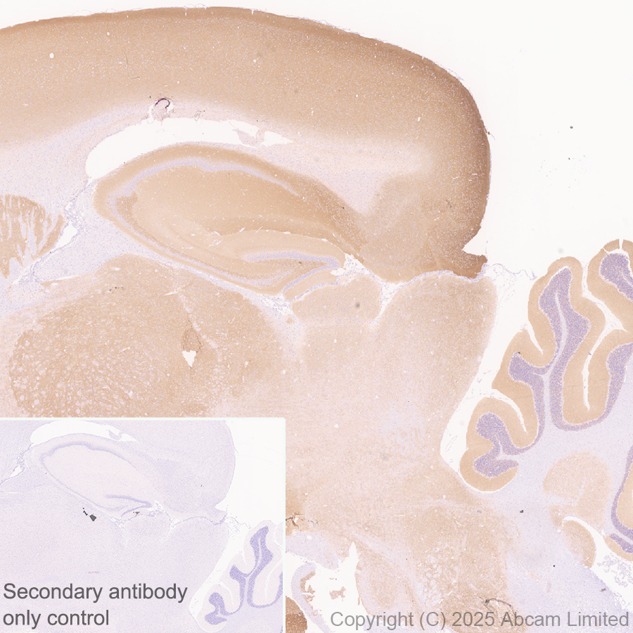 Immunohistochemistry (Formalin/PFA-fixed paraffin-embedded sections) - Anti-GABRA4 antibody [EPR28365-209] (AB323502), expandable thumbnail