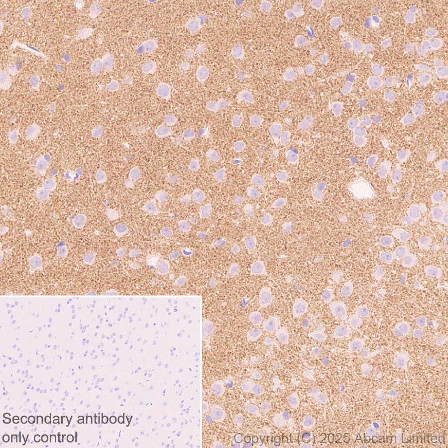 Immunohistochemistry (Formalin/PFA-fixed paraffin-embedded sections) - Anti-GABRA4 antibody [EPR28365-209] (ab323502), expandable thumbnail