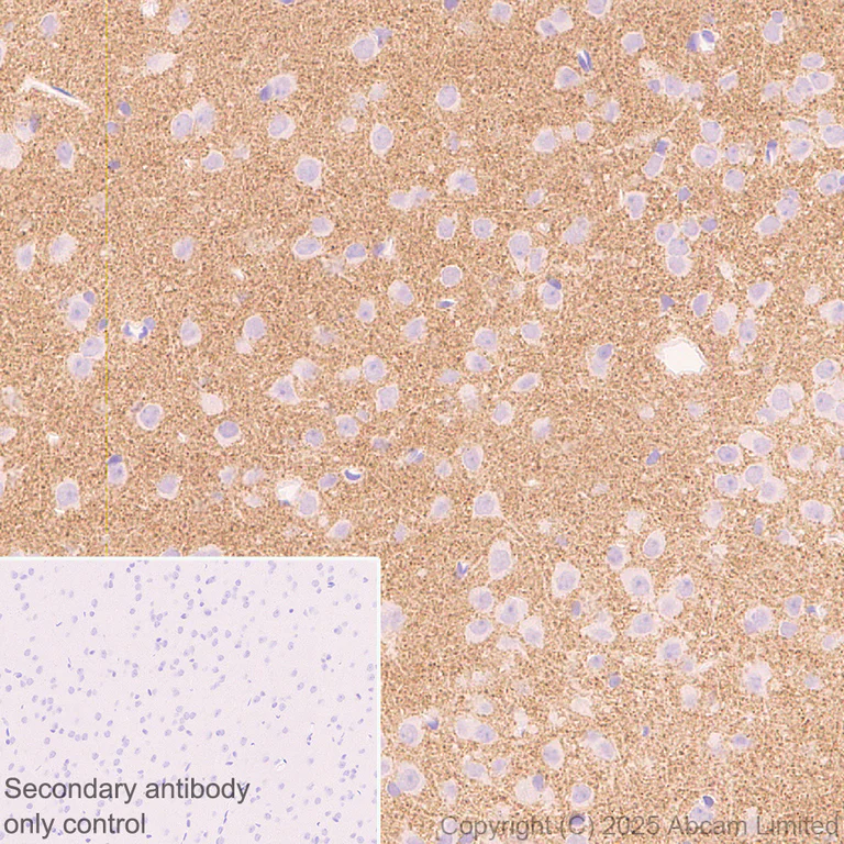 Immunohistochemistry (Formalin/PFA-fixed paraffin-embedded sections) - Anti-GABRA4 antibody [EPR28365-209] (AB323502)
