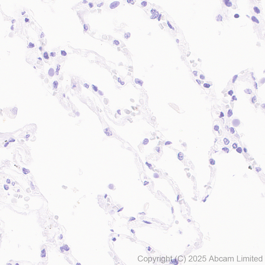 Immunohistochemistry (Formalin/PFA-fixed paraffin-embedded sections) - Anti-GABRA4 antibody [EPR28365-209] (ab323502), expandable thumbnail