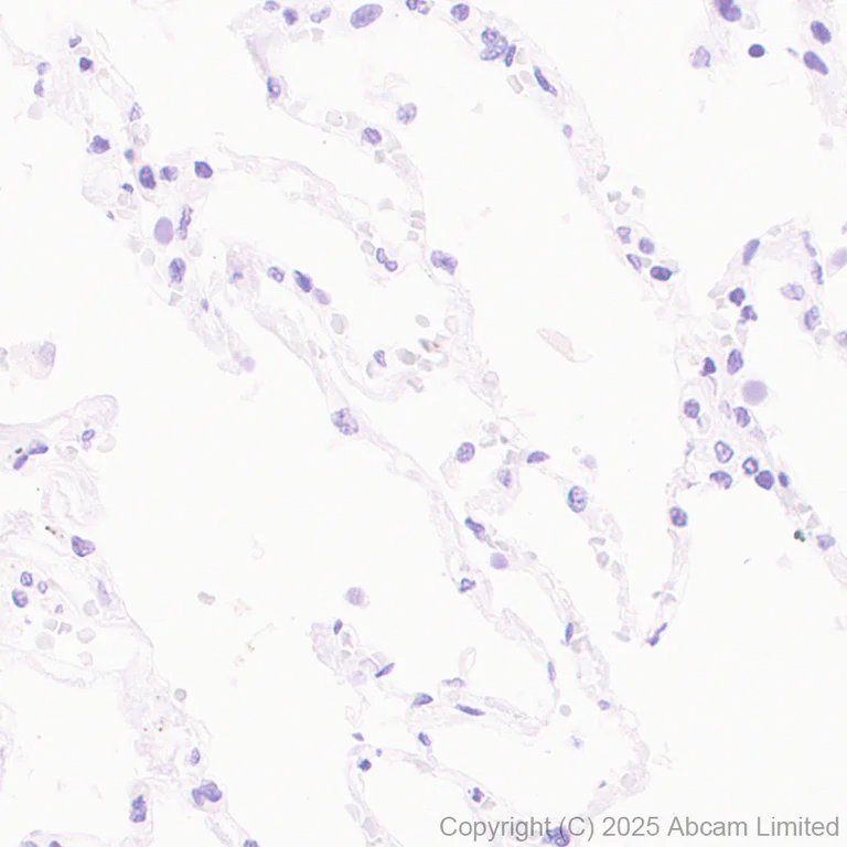 Immunohistochemistry (Formalin/PFA-fixed paraffin-embedded sections) - Anti-GABRA4 antibody [EPR28365-209] (AB323502)