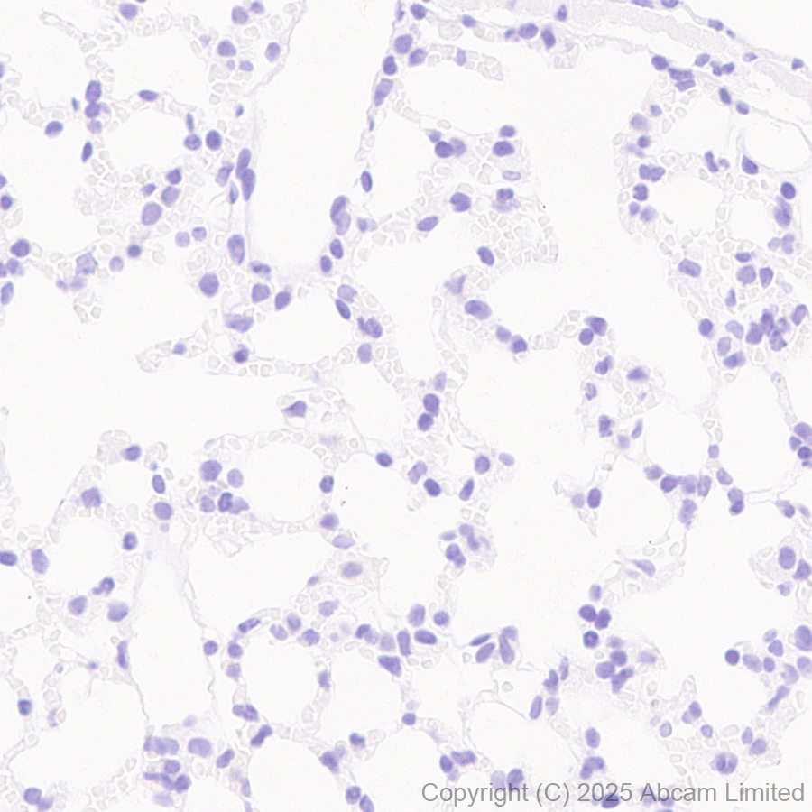 Immunohistochemistry (Formalin/PFA-fixed paraffin-embedded sections) - Anti-GABRA4 antibody [EPR28365-209] (ab323502), expandable thumbnail