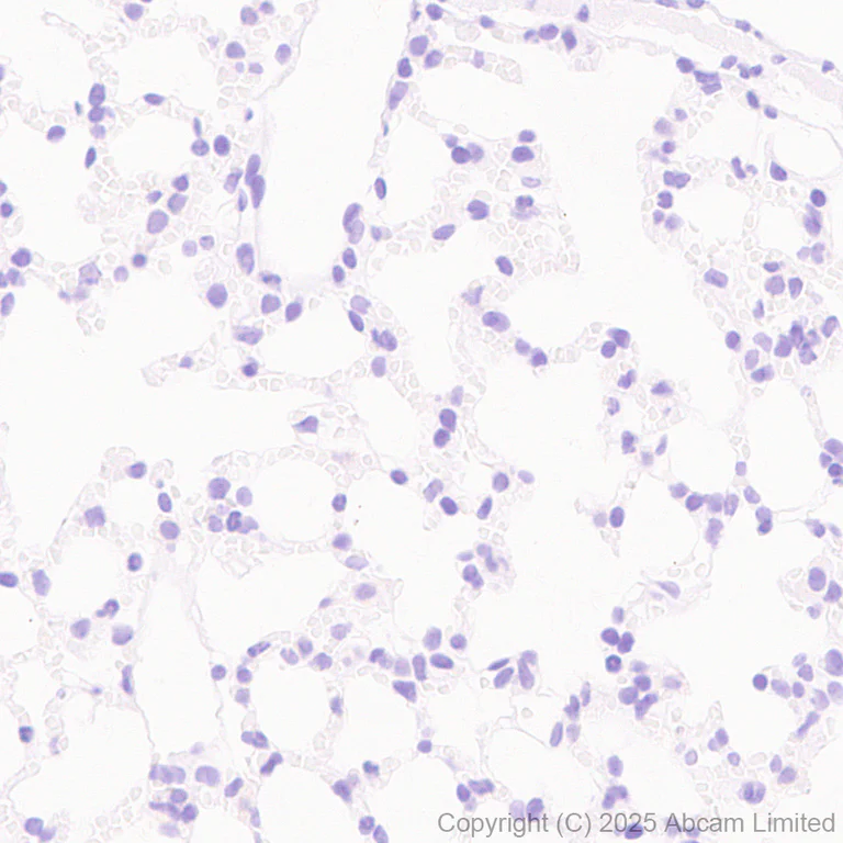 Immunohistochemistry (Formalin/PFA-fixed paraffin-embedded sections) - Anti-GABRA4 antibody [EPR28365-209] (AB323502)