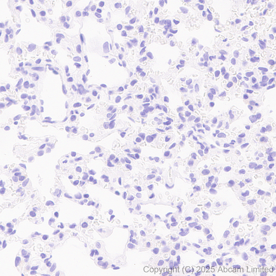 Immunohistochemistry (Formalin/PFA-fixed paraffin-embedded sections) - Anti-GABRA4 antibody [EPR28365-209] (ab323502), expandable thumbnail