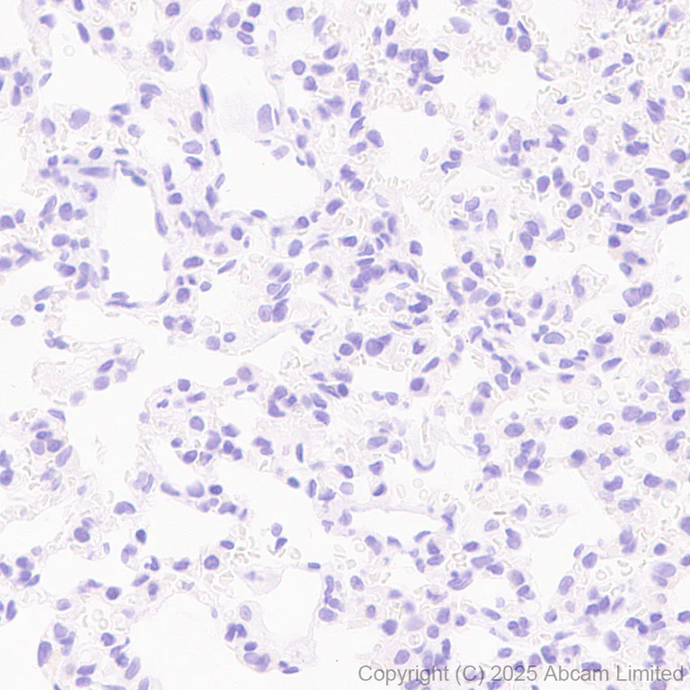 Immunohistochemistry (Formalin/PFA-fixed paraffin-embedded sections) - Anti-GABRA4 antibody [EPR28365-209] (AB323502)
