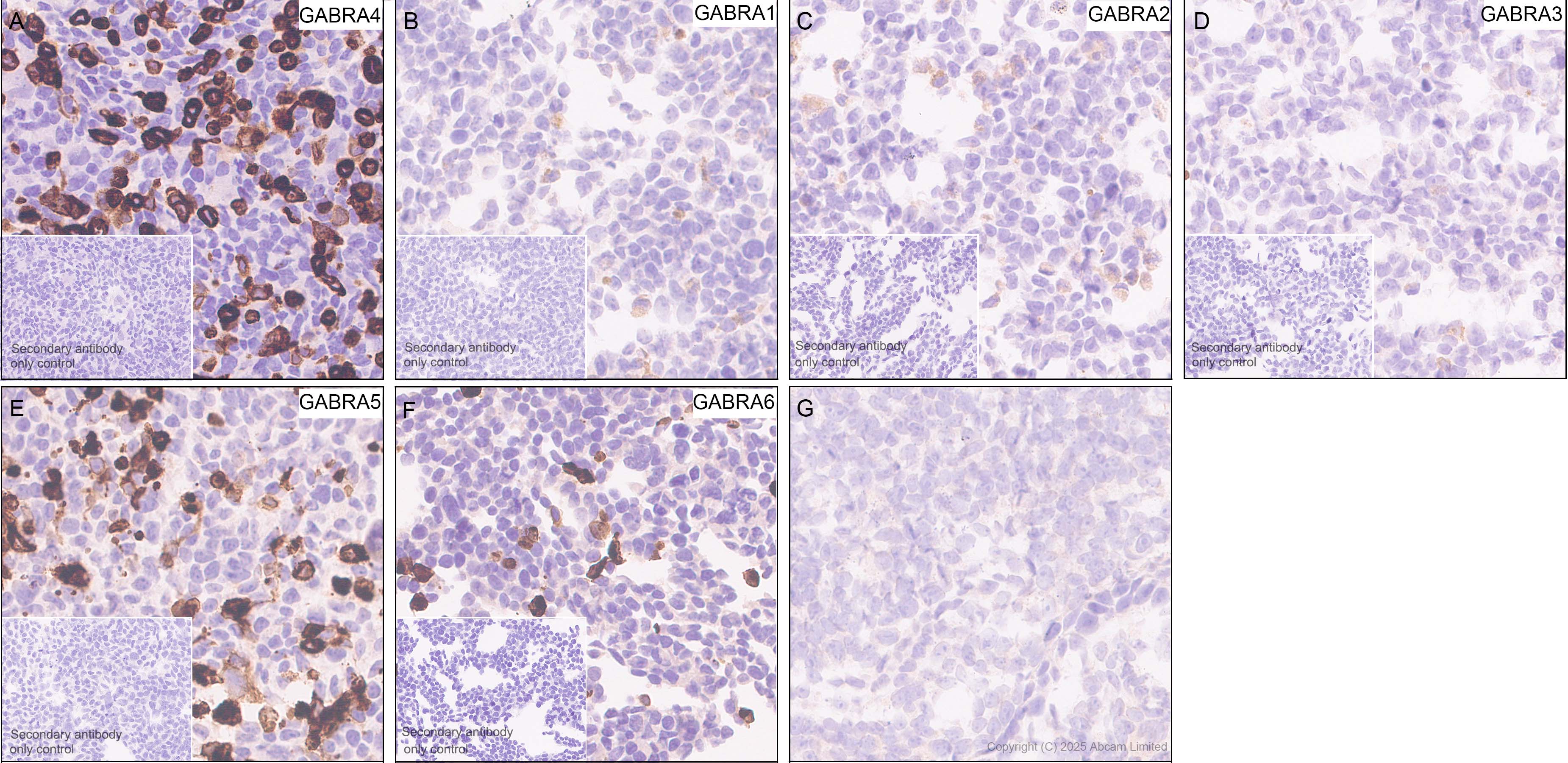 Immunohistochemistry (Formalin/PFA-fixed paraffin-embedded sections) - Anti-GABRA4 antibody [EPR28365-209] (ab323502), expandable thumbnail