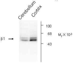 Western blot - Anti-GABRB1 antibody (AB16703)