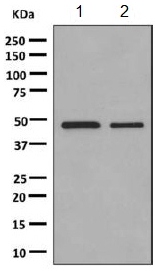 Western blot - Anti-GABRB1 antibody [EPR10343] (AB154822)