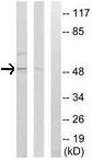 Western blot - Anti-GABRD antibody (AB110014)