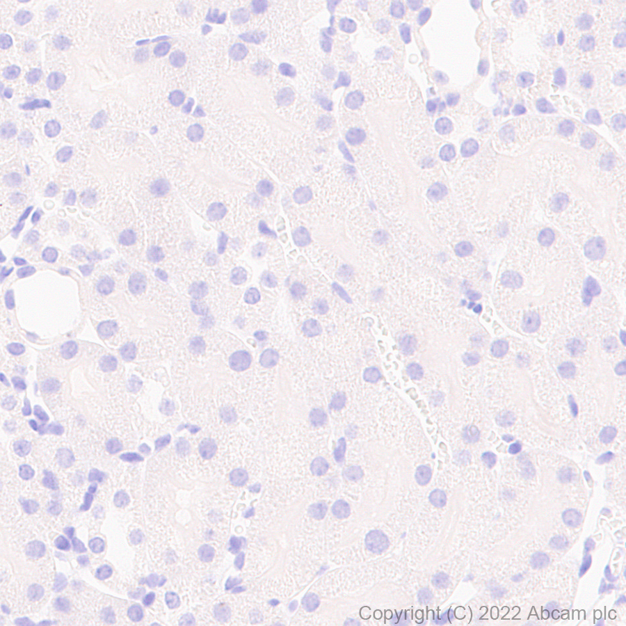 Immunohistochemistry (Formalin/PFA-fixed paraffin-embedded sections) - Anti-GABRD antibody [EPR25324-253] (AB300348)