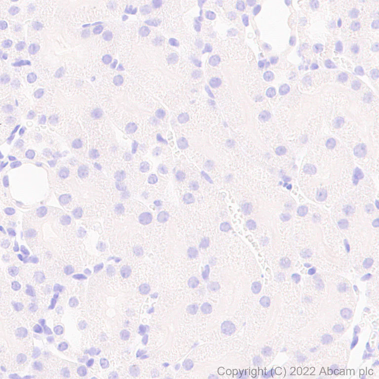 Immunohistochemistry (Formalin/PFA-fixed paraffin-embedded sections) - Anti-GABRD antibody [EPR25324-253] (BSA and Azide free) (AB300351)