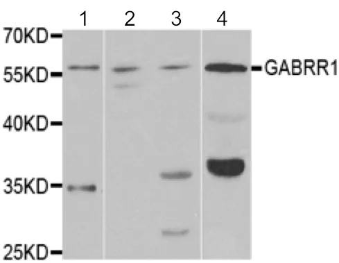 Western blot - Anti-GABRR1 antibody (AB189875)