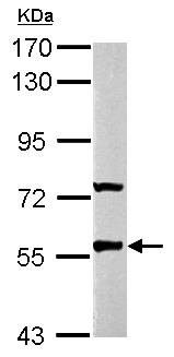 Western blot - Anti-GABRR2 antibody (AB153961), expandable thumbnail