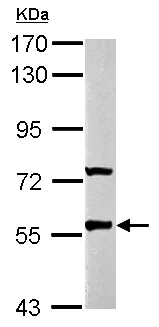 Western blot - Anti-GABRR2 antibody (AB153961)