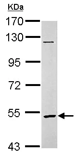 Western blot - Anti-GABRR2 antibody (AB153961)