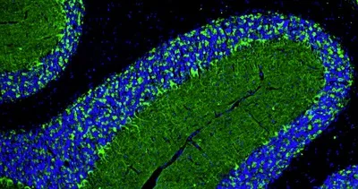 Immunohistochemistry (Formalin/PFA-fixed paraffin-embedded sections) - Anti-GAD1 antibody [L127/12] - Chicken IgY (Chimeric) (AB325669)