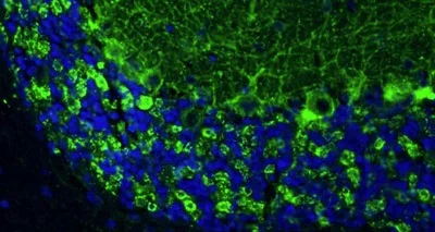 Immunohistochemistry (Formalin/PFA-fixed paraffin-embedded sections) - Anti-GAD1 antibody [L127/12] - Chicken IgY (Chimeric) (AB325669)