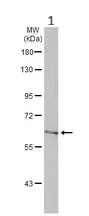Western blot - Anti-gad1b antibody (AB209717)