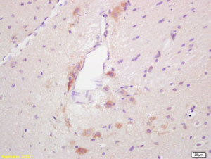 Immunohistochemistry (Formalin/PFA-fixed paraffin-embedded sections) - Anti-GAD65 antibody (AB203063), expandable thumbnail