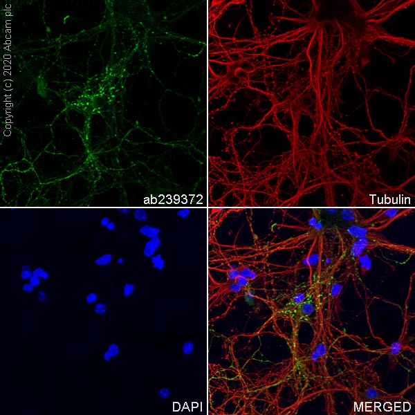 Immunocytochemistry/ Immunofluorescence - Anti-GAD65 antibody [EPR22952-70] (ab239372), expandable thumbnail