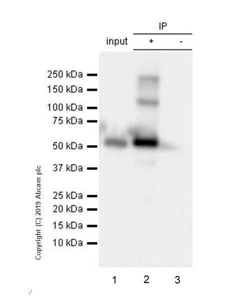 Immunoprecipitation - Anti-GAD65 antibody [EPR22952-70] (ab239372), expandable thumbnail