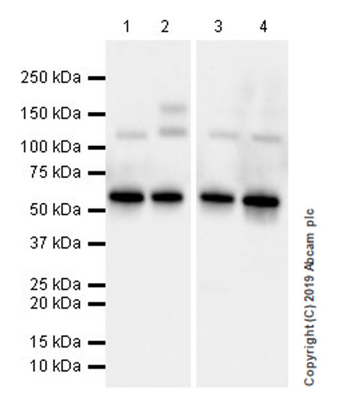 Western blot - Anti-GAD65 antibody [EPR22952-70] (AB239372), expandable thumbnail