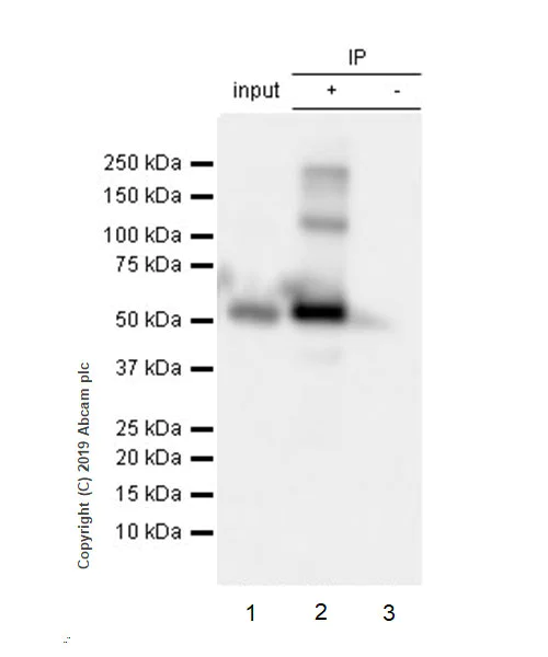 Immunoprecipitation - Anti-GAD65 antibody [EPR22952-70] - BSA and Azide free (AB270037)