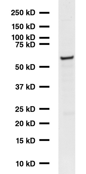 Western blot - Anti-GAD65 antibody [GAD-6] (AB26113), expandable thumbnail
