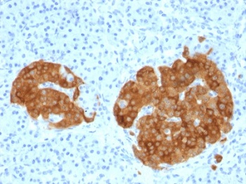 Immunohistochemistry (Formalin/PFA-fixed paraffin-embedded sections) - Anti-GAD65 antibody [GAD2/1960] - BSA and Azide free (AB237843)