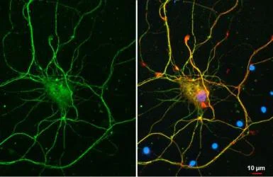 Immunocytochemistry/ Immunofluorescence - Anti-GAD65 antibody [HL1187] (AB307489)