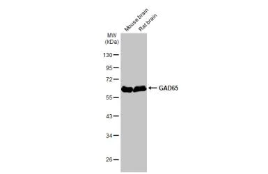 Western blot - Anti-GAD65 antibody [HL1187] (AB307489)