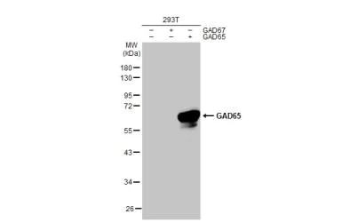 Western blot - Anti-GAD65 antibody [HL1187] (AB307489)