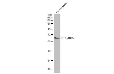 Western blot - Anti-GAD65 antibody [HL1187] (AB307489)
