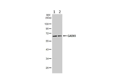 Western blot - Anti-GAD65 antibody [HL1187] (AB307489)